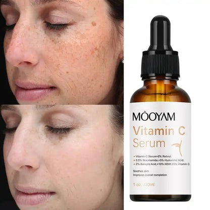 Ser Anti-Hiperpigmentare cu Vitamina C 20% Mooyam Vitamin C Serum