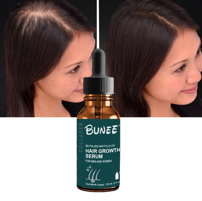 Ser pentru regenerarea parului Bunee Hair Growth Serum cu minoxidil 5%