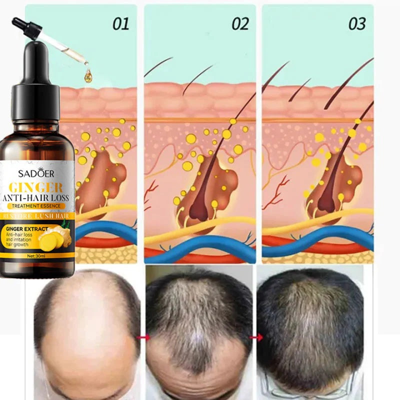 Ser pentru cresterea si regenerarea parului cu extract de ghimbir, Sadoer Ginger Anti-Hair Loss