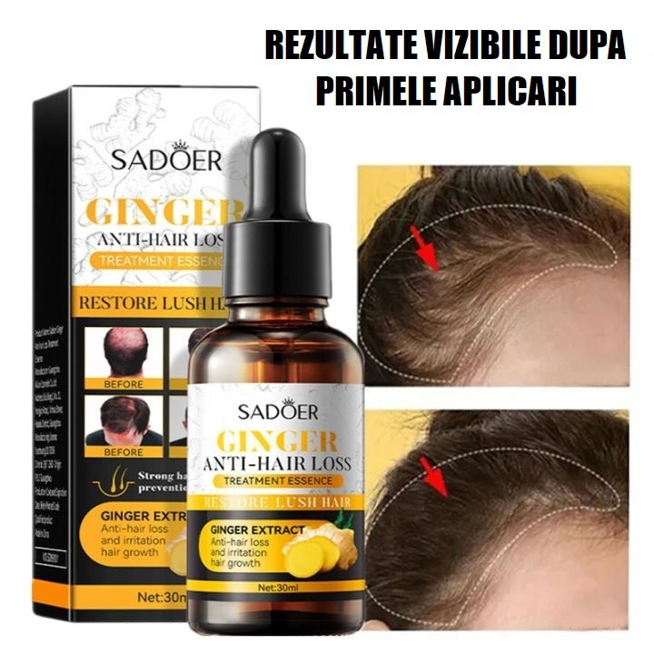 Ser pentru cresterea si regenerarea parului cu extract de ghimbir, Sadoer Ginger Anti-Hair Loss