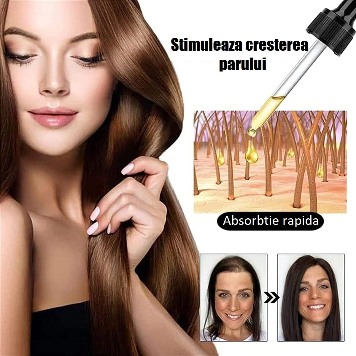 Ser pentru cresterea si regenerarea parului cu extract de ghimbir, Sadoer Ginger Anti-Hair Loss