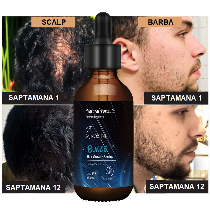 Ser pentru regenerarea parului Bunee Hair Growth Serum Biotin + Collagen + 5% Minoxidil