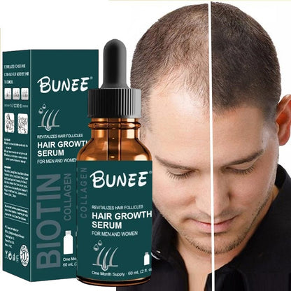 Ser pentru regenerarea parului Bunee Hair Growth Serum cu minoxidil 5%