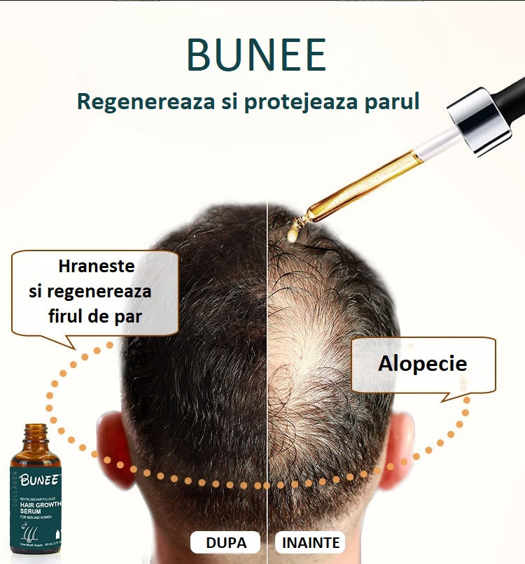 Ser pentru regenerarea parului Bunee Hair Growth Serum cu minoxidil 5%