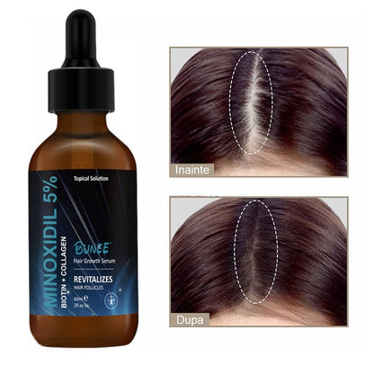 Ser pentru regenerarea parului Bunee Hair Growth Serum Biotin + Collagen + 5% Minoxidil