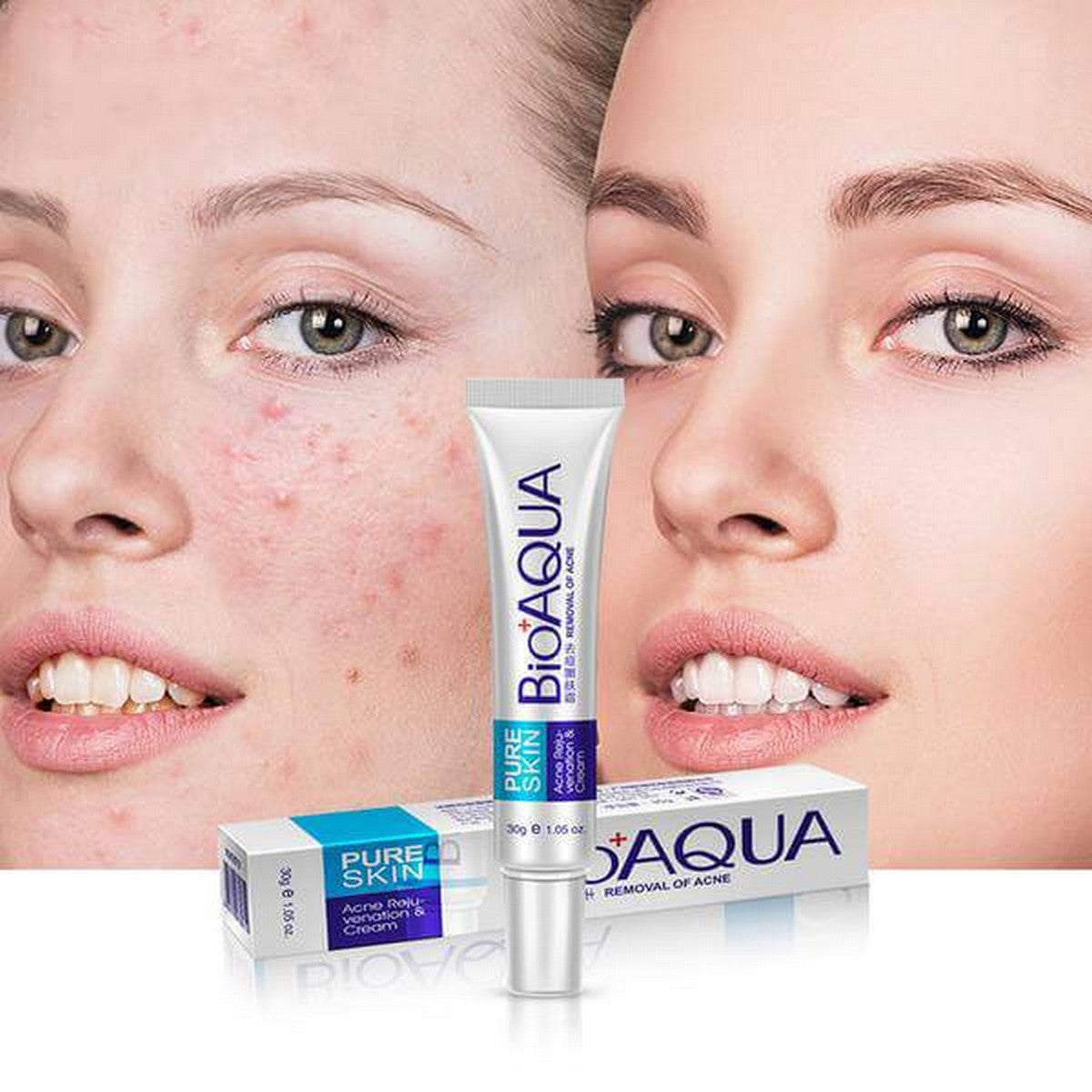 Crema antiacneica tratament Bioaqua Pure Skin